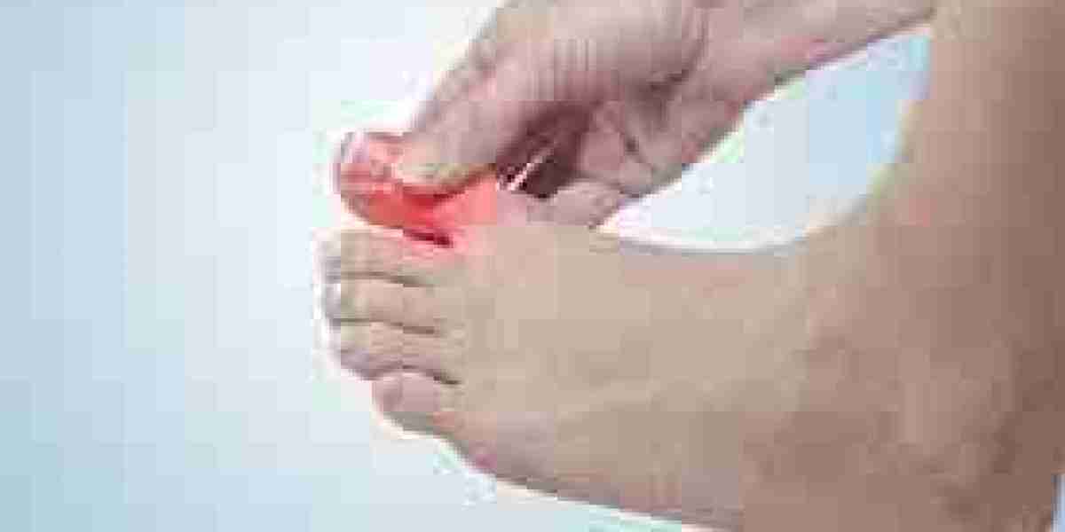 Toe Pain: What Does Pain in Toes Indicate?
