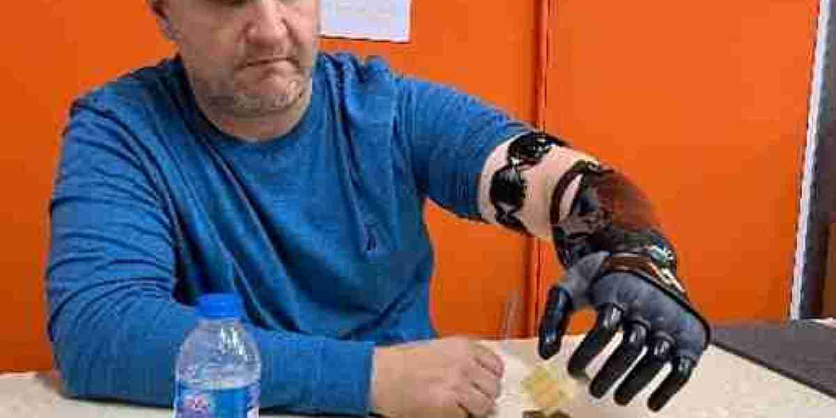 Deciphering the Marvel: The Comprehensive Guide to Prosthetic Arms