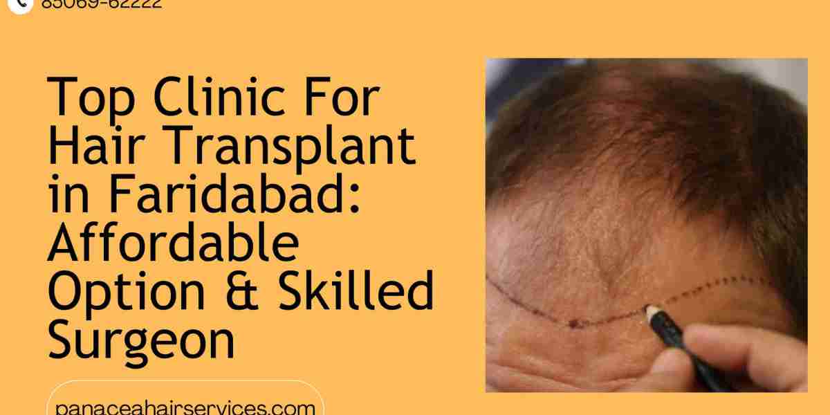 Top Clinic For Hair Transplant In Faridabad Affordable Option And Skilled Surgeon