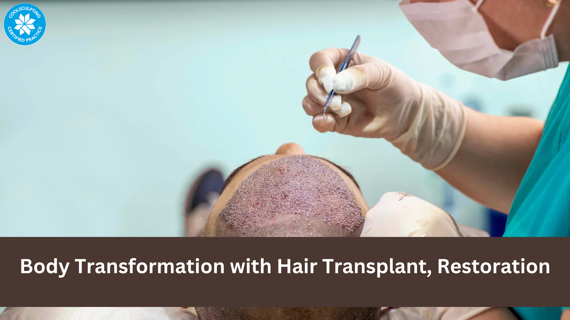 Unlocking Confidence: A Comprehensive Guide to Body Transformation with Hair Transplant, Restoration, and More - ViralSocialTrends