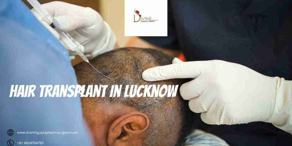 Divine Cosmetic Surgery: Leading the Way with Exceptional Hair Transplant in Lucknow