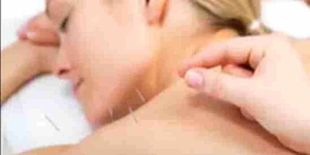Holistic Healing with Acupuncture in Morristown at CM Harmony