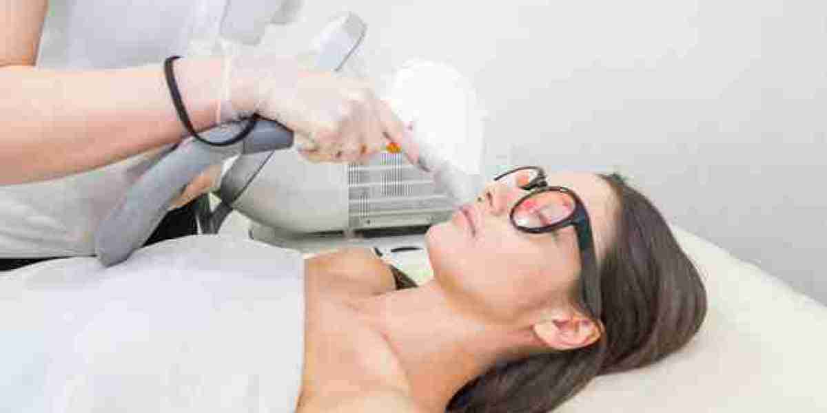 Radiance, Reborn: Face Laser Treatments for Ageless Skin