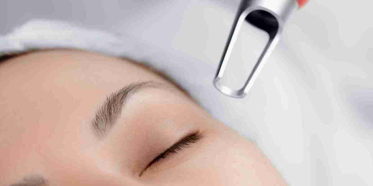 Pico Laser Treatment for Brightening Dull Skin Complexion