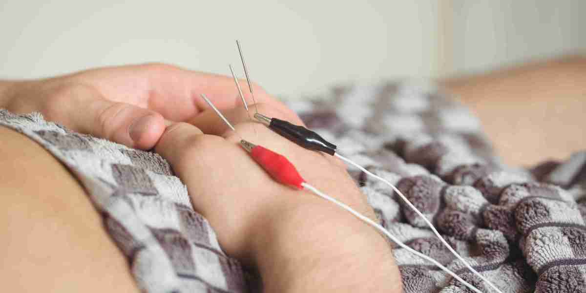 Unlocking Fertility Naturally With Acupuncture
