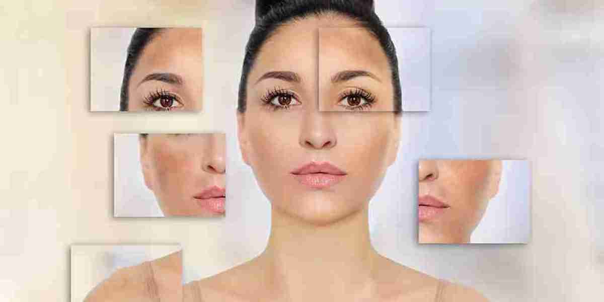 How to Combine Skincare with Melasma Treatment
