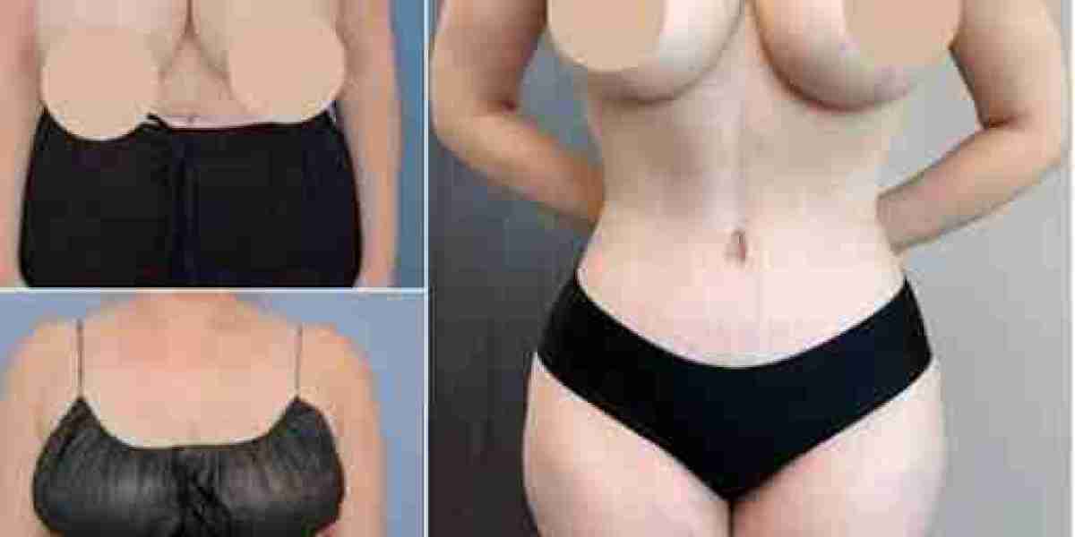 Best Doctors in Dubai for Tummy Tuck and Refined Body Contours