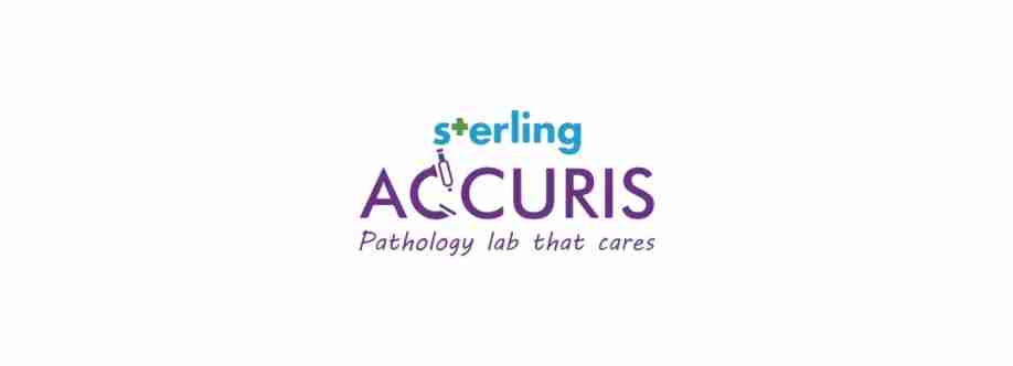 Sterling Accuris Cover Image